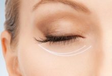 Как убрать морщины вокруг глаз и предотвратить их появление при помощи натуральных средств